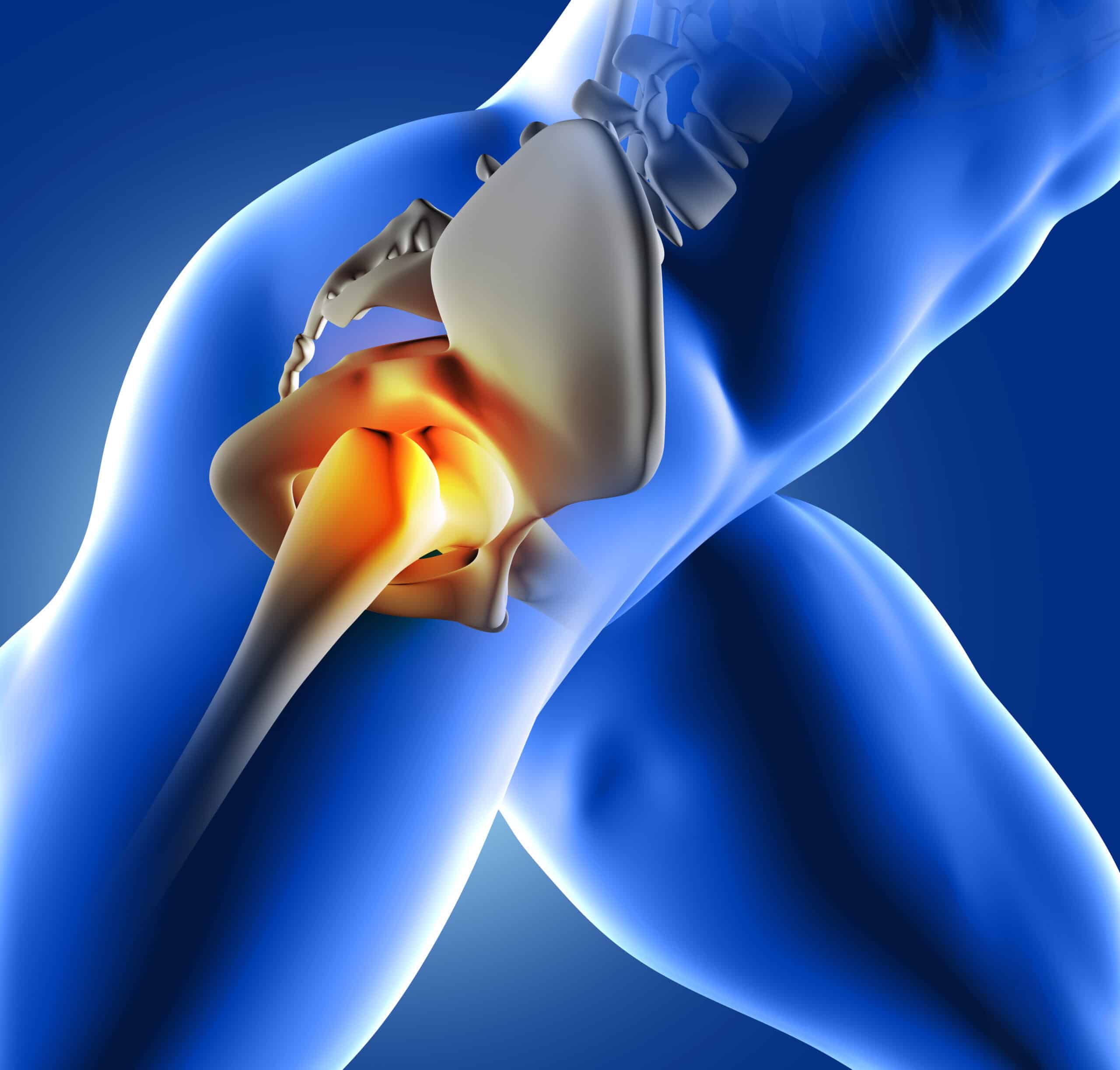 Piriformis syndrome and discogenic pain, Is it the same?